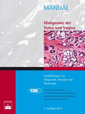 cover image of Malignome der Vulva und Vagina